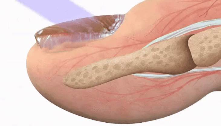 CONCLUSION: Hewelth™ BioClear Wipes Out Fungus Unlike Anything Else We’ve Seen